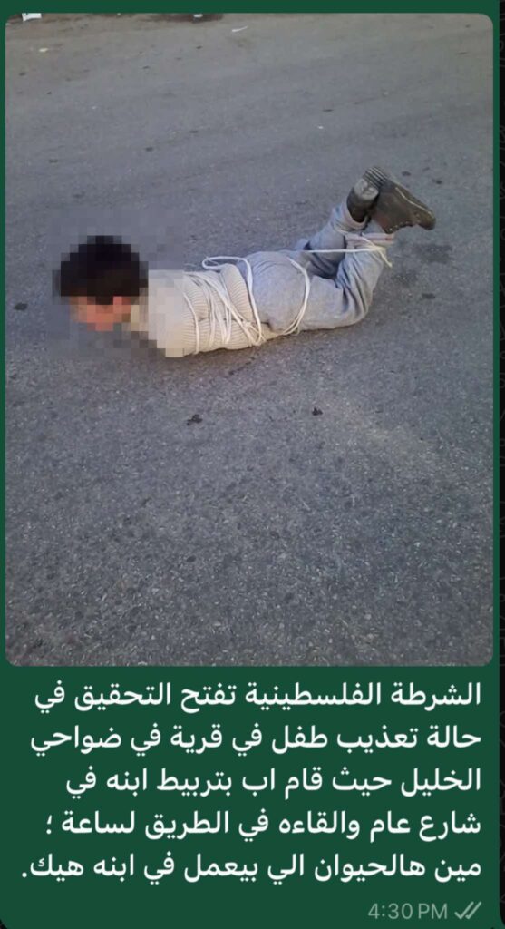 الشرطة الفلسطينية تنفي التحقيق في صورة طفل تعرض للتعذيب في الخليل
