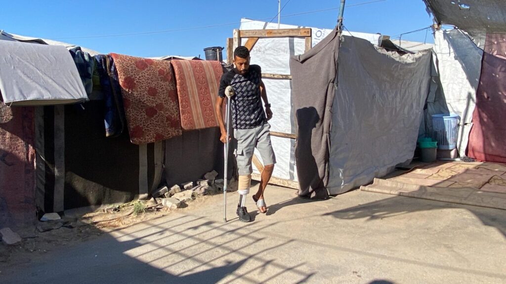 War Innovation: Prosthetic Limb Made from “Plastic Waste”